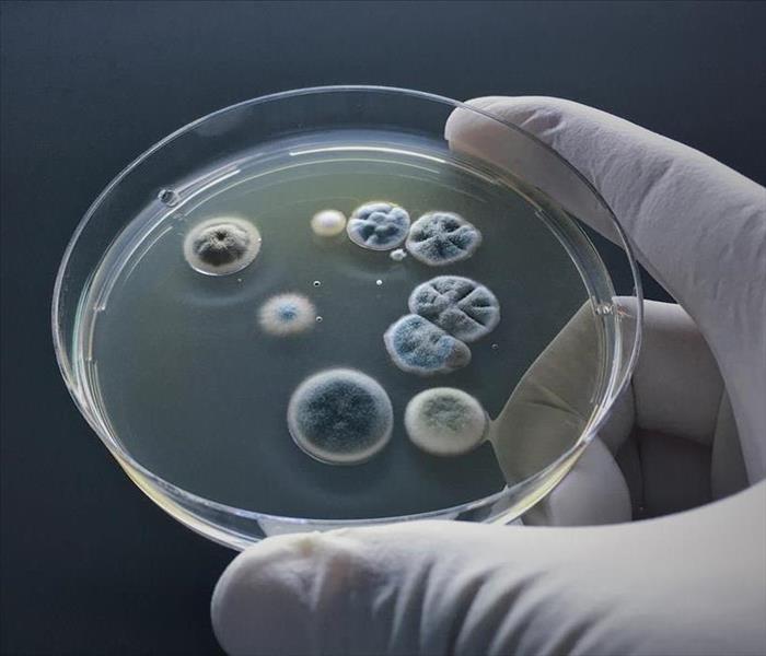 Scientist show molds in agar culture.